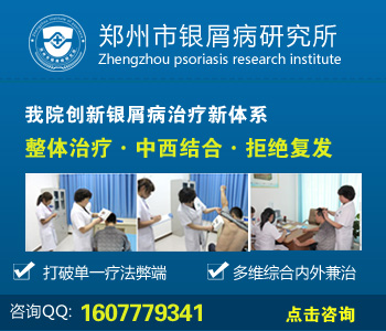 郑州银屑病研究院怎么样