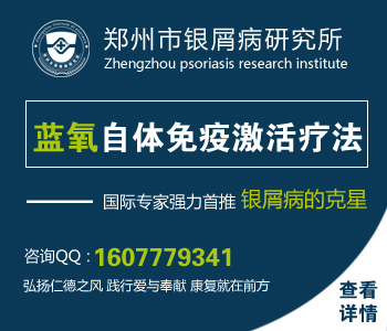 郑州治疗银屑病的医院