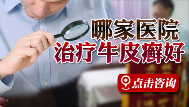 新乡市哪医院看牛皮癣最好